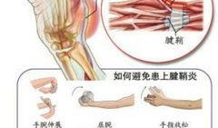 手腕腱鞘炎按摩视频,专业按摩视频教程解析