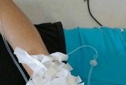 一半屁股打两针视频,揭秘一半屁股注射之谜